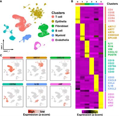 Single-cell profiling reveals that SAA1+ epithelial cells promote distant metastasis of esophageal squamous cell carcinoma